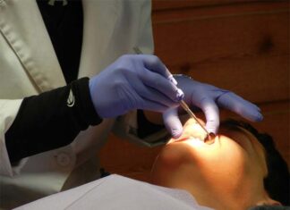 Ile kosztuje usunięcie zęba Poznań