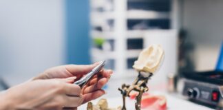 Kompleksowy przewodnik po protezach i implantach